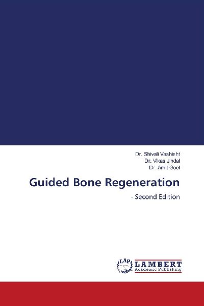 Guided Bone Regeneration: - Second Edition
