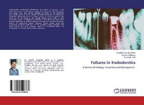 Failures in Endodontics: A Review of Etiology, Prevention and Management