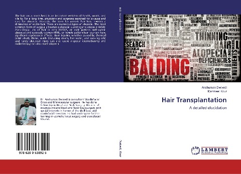 Hair Transplantation: A detailed elucidation