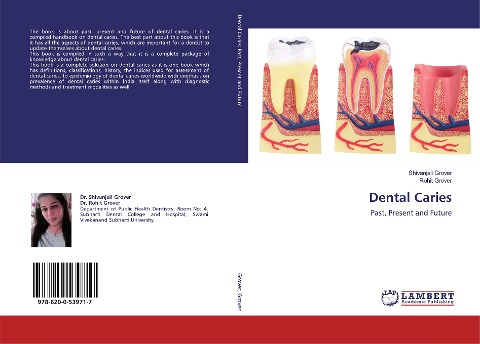 Dental Caries: Past, Present and Future