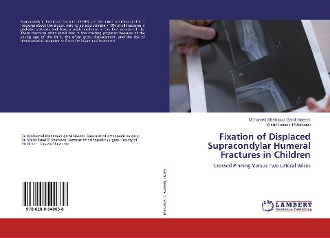 Fixation of Displaced Supracondylar Humeral Fractures in Children: Crossed Pinning Versus Two Lateral Wires