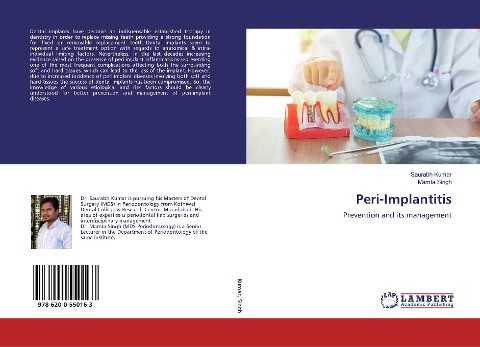 Peri-Implantitis: Prevention and its management