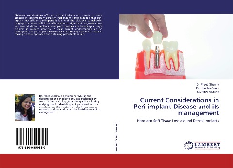 Current Considerations in Peri-implant Disease and its management: Hard and Soft Tissue Loss around Dental implants