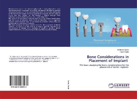 Bone Considerations in Placement of Implant: This book studying the bone considerations for the placement of dental implants