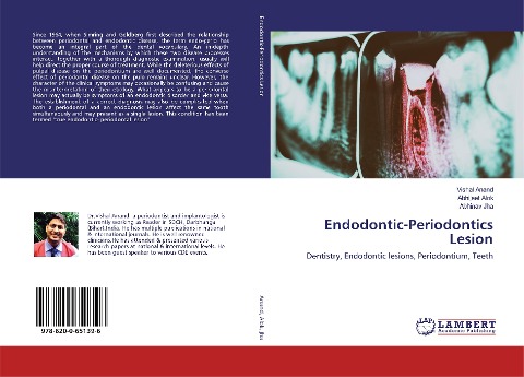 Endodontic-Periodontics Lesion: Dentistry, Endodontic lesions, Periodontium, Teeth