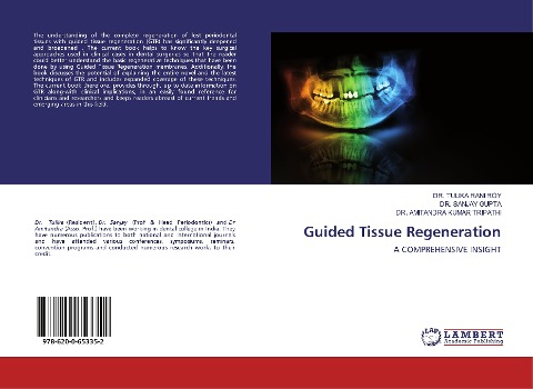 Guided Tissue Regeneration: A COMPREHENSIVE INSIGHT