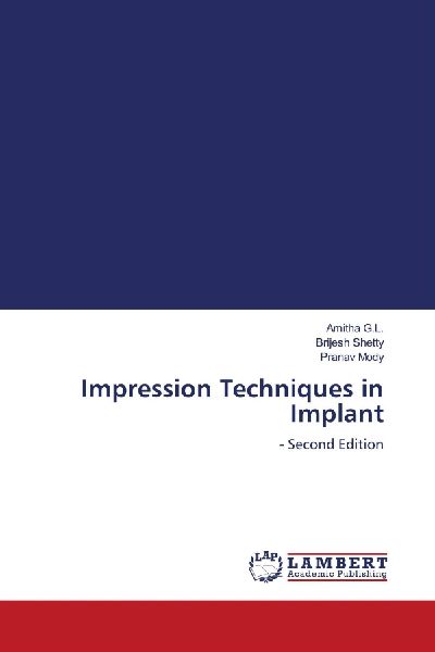Impression Techniques in Implant: - Second Edition