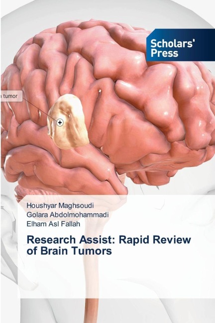 Research Assist: Rapid Review of Brain Tumors