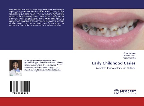 Early Childhood Caries: Complete Review of Caries in Children
