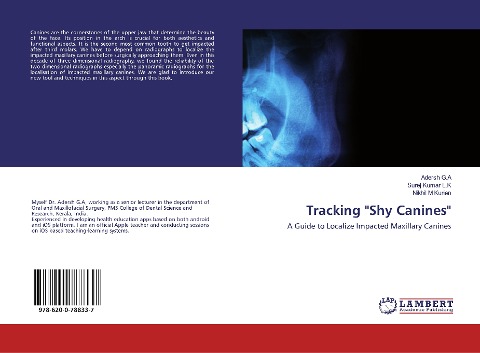 Tracking Shy Canines: A Guide to Localize Impacted Maxillary Canines