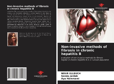 Non-invasive methods of fibrosis in chronic hepatitis B: Evaluation of non-invasive methods for fibrosishepatic in chronic hepatitis B in a Tunisian population