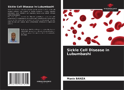 Sickle Cell Disease in Lubumbashi