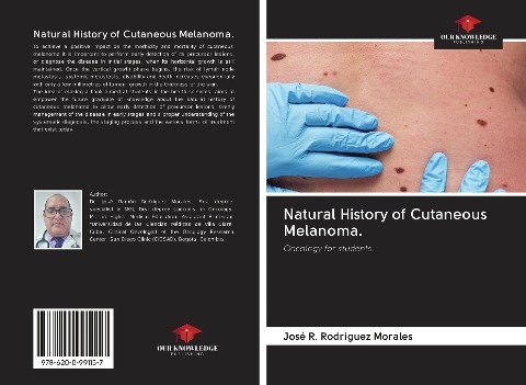 Natural History of Cutaneous Melanoma.: Oncology for students.