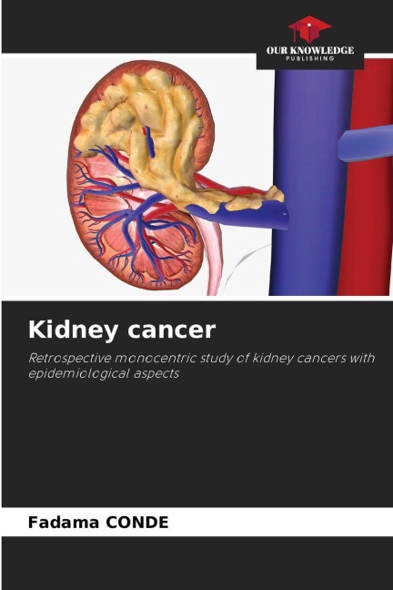 Kidney cancer: Retrospective monocentric study of kidney cancers with epidemiological aspects