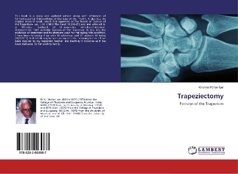 Trapeziectomy: Excision of the Trapezium