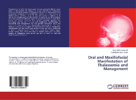 Oral and Maxillofacial Manifestation of Thalassemia and Management