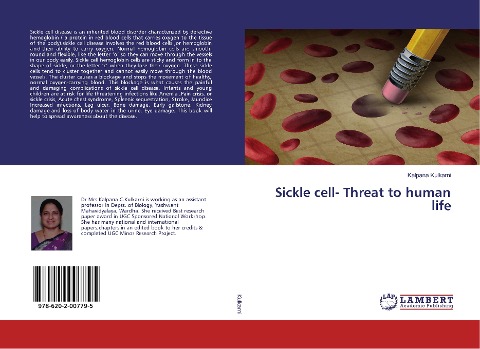 Sickle cell- Threat to human life