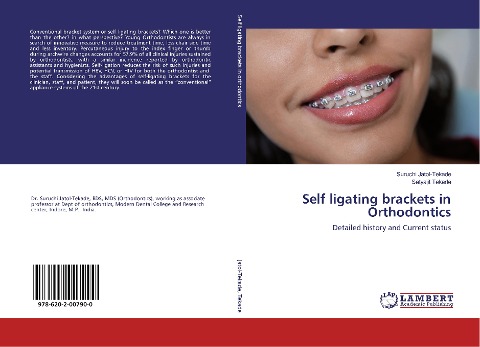 Self ligating brackets in Orthodontics: Detailed history and Current status