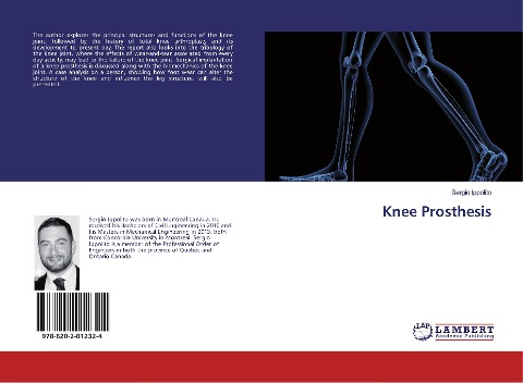 Knee Prosthesis