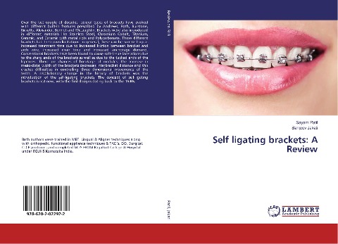 Self ligating brackets: A Review