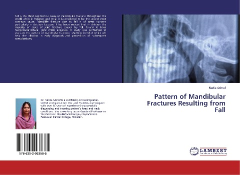 Pattern of Mandibular Fractures Resulting from Fall