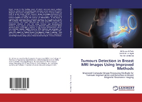Tumours Detection in Breast MRI Images Using Improved Methods: Improved Computer Image Processing Methods for Tumours Segmentation and Detection in Breast Magnetic Resonance Imaging