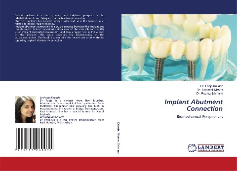 Implant Abutment Connection: Biomechanical Perspectives