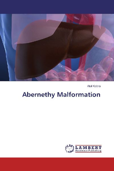 Abernethy Malformation