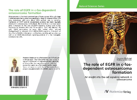 The role of EGFR in c-fos-dependent osteosarcoma formation: An insight into the cell signaling network in osteosarcoma