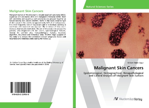 Malignant Skin Cancers: Epidemiological, Demographical, Histopathological and Clinical Analysis of Malignant Skin Tumors