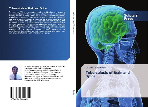 Tuberculosis of Brain and Spine