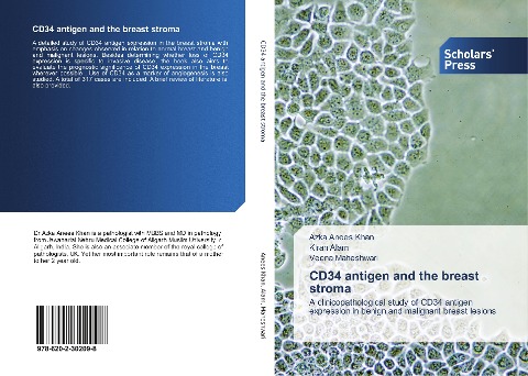 CD34 antigen and the breast stroma: A clinicopathological study of CD34 antigen expression in benign and malignant breast lesions