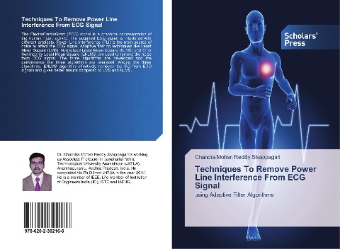 Techniques To Remove Power Line Interference From ECG Signal: using Adaptive Filter Algorithms