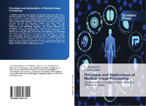 Principles and Applications of Medical Image Processing: Reconstruction of Cortical Surface in Magnetic Resonance Images