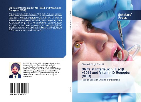 SNPs at Interleukin (IL)-1¿ +3954 and Vitamin D Receptor (VDR): Role of SNPs in Chronic Periodontitis