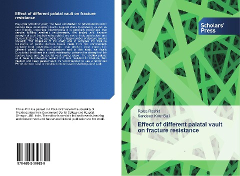 Effect of different palatal vault on fracture resistance