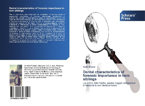 Dental characteristics of forensic importance in twin siblings: Lip prints, bite marks, palatal ruggae comparison in identical & non identical twins