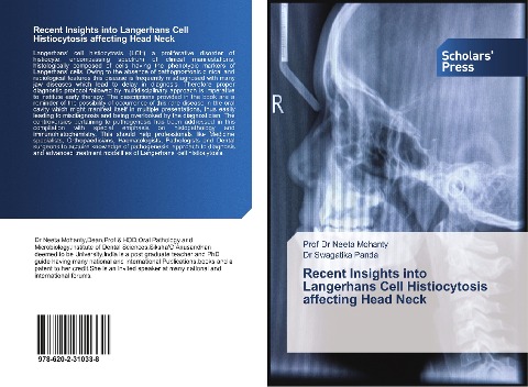 Recent Insights into Langerhans Cell Histiocytosis affecting Head Neck