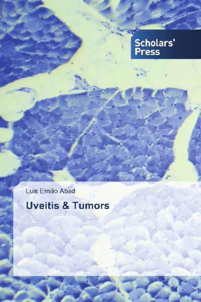 Uveitis & Tumors