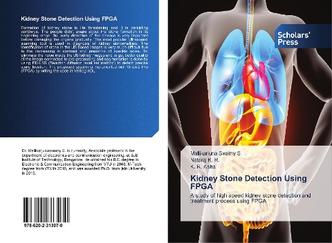 Kidney Stone Detection Using FPGA: A study of high speed kidney stone detection and treatment process using FPGA