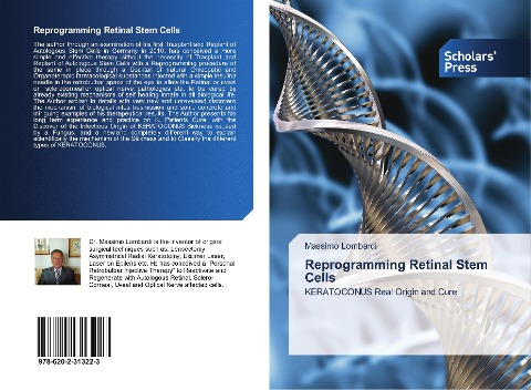 Reprogramming Retinal Stem Cells: KERATOCONUS Real Origin and Cure