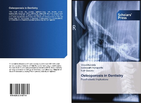 Osteoporosis in Dentistry: Prosthodontic Implications