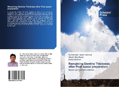 Remaining Dentine Thickness after Post space preparation: Based upon current evidence