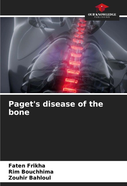 Pagets disease of the bone
