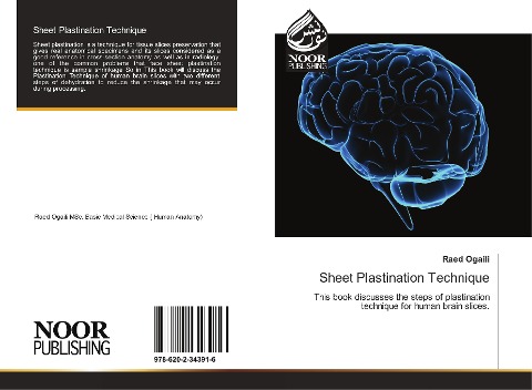 Sheet Plastination Technique: This book discusses the steps of plastination technique for human brain slices.