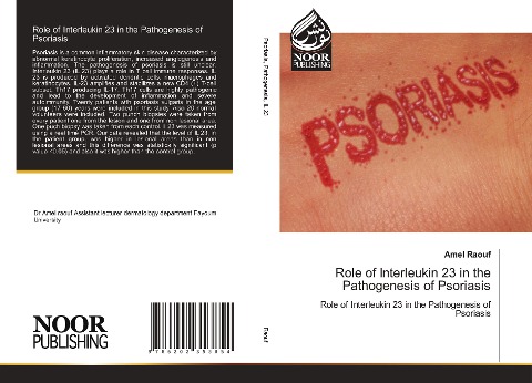 Role of Interleukin 23 in the Pathogenesis of Psoriasis: Role of Interleukin 23 in the Pathogenesis of Psoriasis