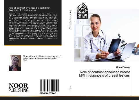 Role of contrast enhanced breast MRI in diagnosis of breast lesions