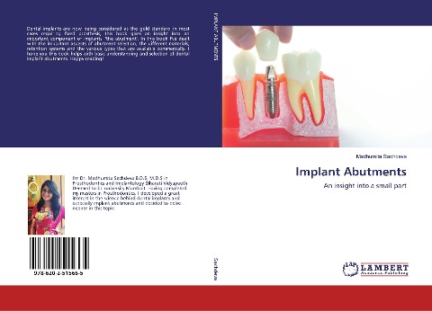 Implant Abutments: An insight into a small part