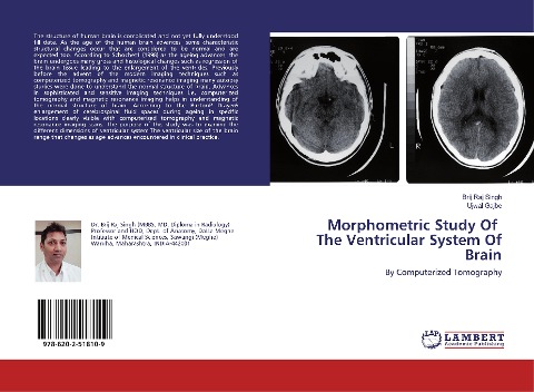 Morphometric Study Of The Ventricular System Of Brain: By Computerized Tomography