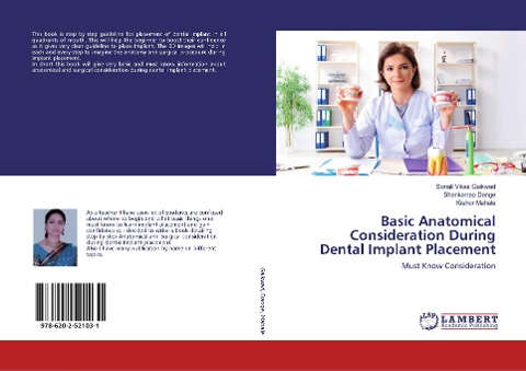 Basic Anatomical Consideration During Dental Implant Placement: Must Know Consideration